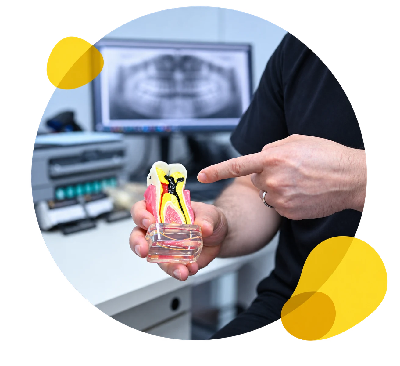 Root Canal Treatment Craigieburn